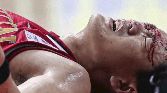 包含江苏队遭遇重创,主力球员受伤的词条 包含江苏队遭遇重创,主力球员受伤的词条